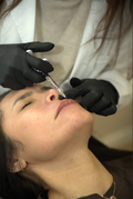Aumento de labios 1ml