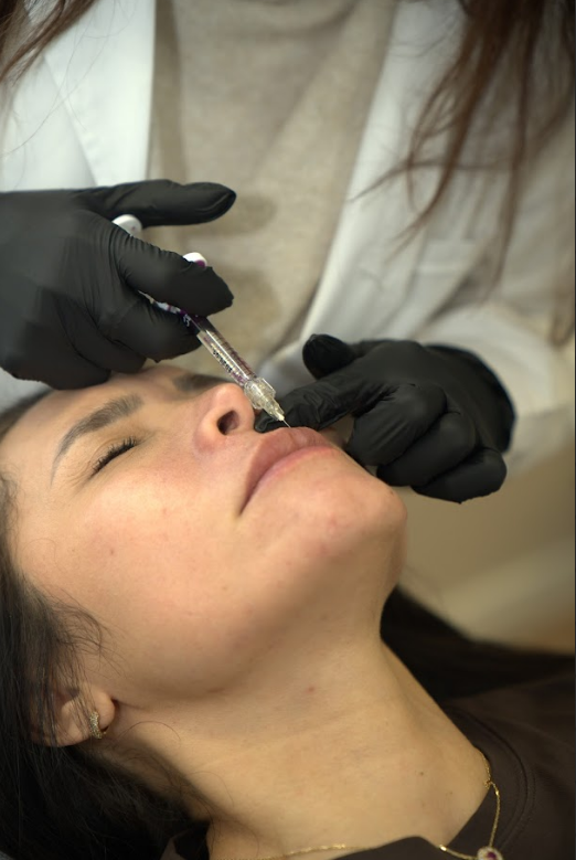 Aumento de labios 1ml