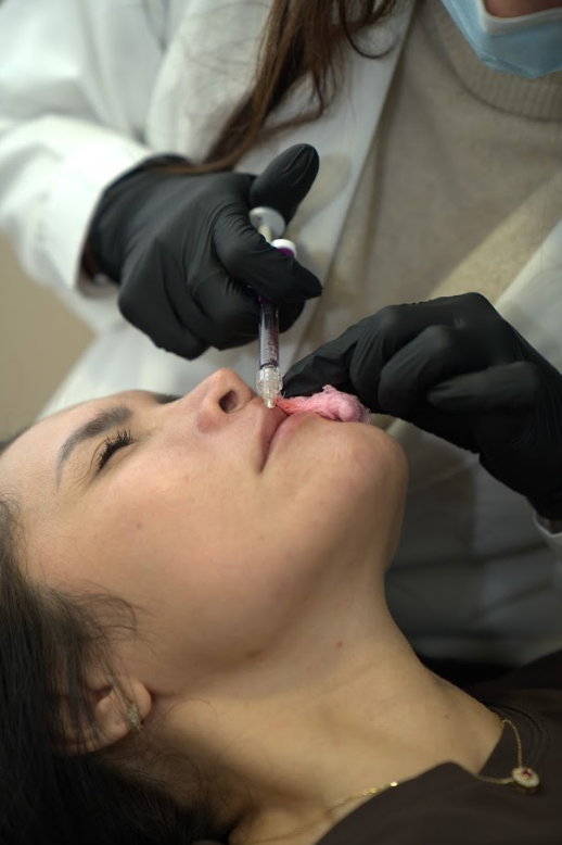 Aumento de labios 1ml